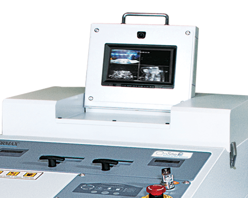 FD 87HDS-R recording system with dual cameras